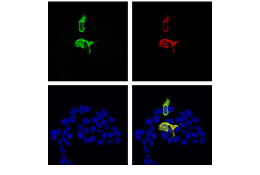 Immunofluorescence Image 1: Cas9 (<i>S. pyogenes</i>) (E7M1H) Rabbit Monoclonal Antibody