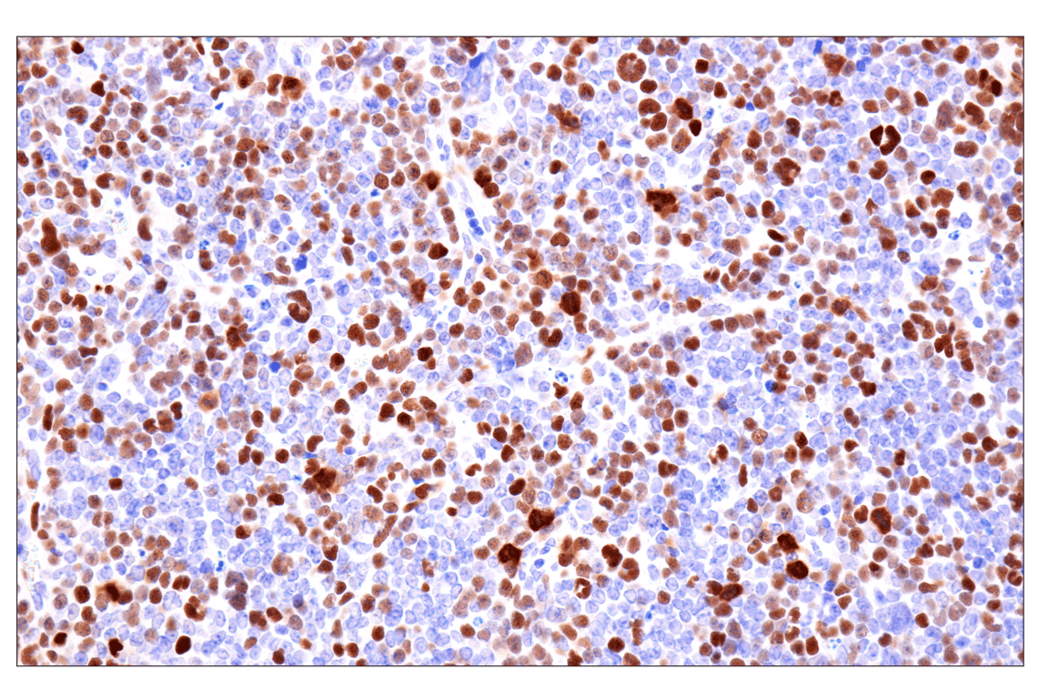 Immunohistochemistry Image 11: Phospho-NPM1 (Thr199) (E4C7S) Rabbit Monoclonal Antibody
