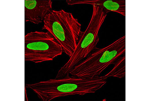 Immunofluorescence Image 1: Lamin A/C (4C11) Mouse Monoclonal Antibody