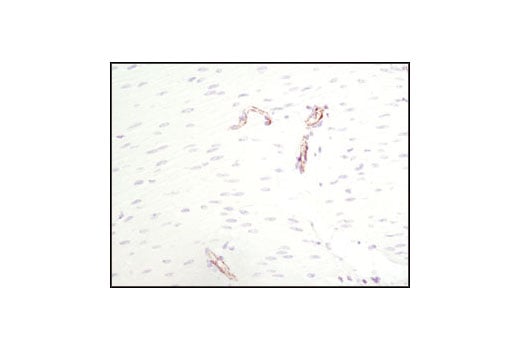 Immunohistochemistry Image 1: CD31 (PECAM-1) (89C2) Mouse Monoclonal Antibody
