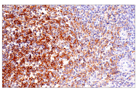 Immunohistochemistry Image 2: CD21/CR2 (2G9) Mouse mAb