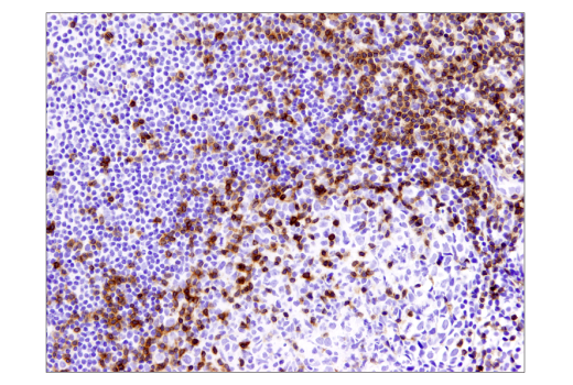 Immunohistochemistry Image 1: CD3 epsilon (D7A6E) Rabbit Monoclonal Antibody (BSA and Azide Free)