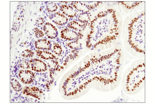 Immunohistochemistry Image 4: LRF/Pokemon (D7U2O) Rabbit Monoclonal Antibody