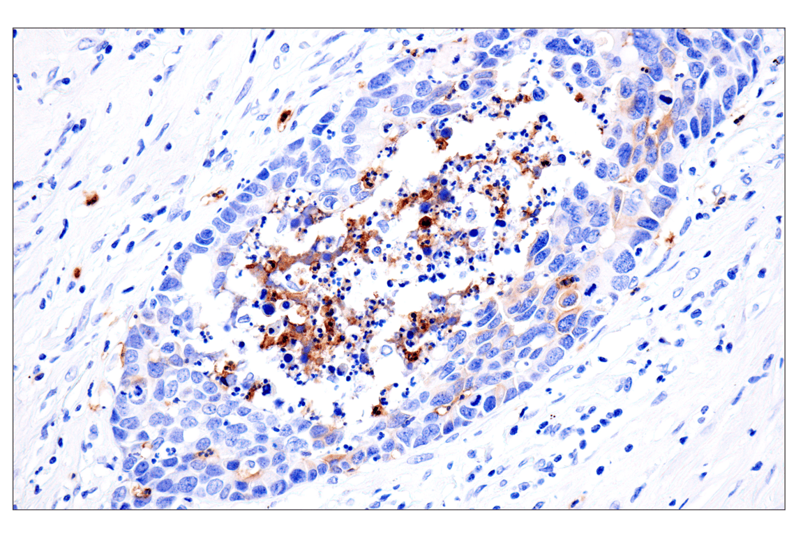 Immunohistochemistry Image 6: CD177 (F9O5U) Rabbit Monoclonal Antibody (BSA and Azide Free)