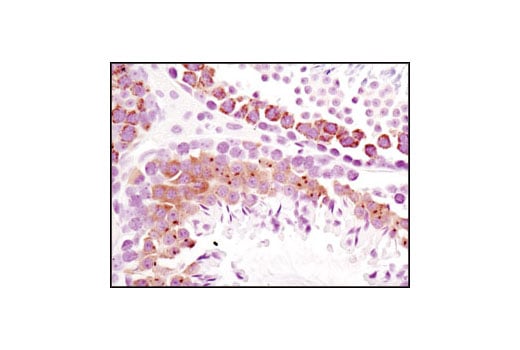 Immunohistochemistry Image 1: Mili Antibody