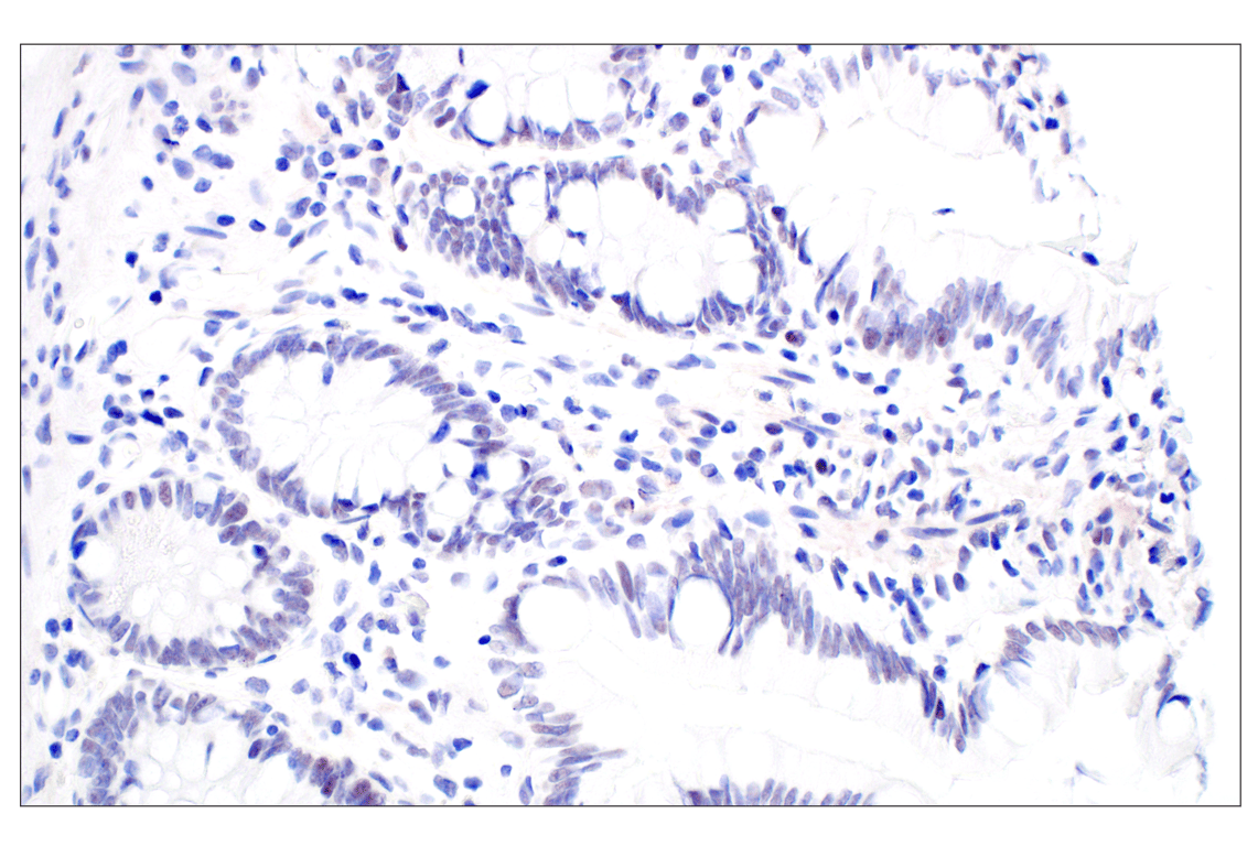 Immunohistochemistry Image 7: MDM2 (F7W7X) Rabbit Monoclonal Antibody (BSA and Azide Free)