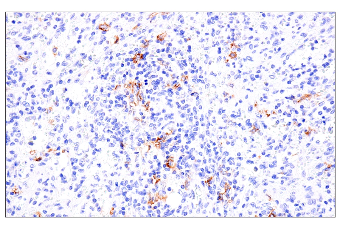Immunohistochemistry Image 6: Cadherin-17 (E5J8Z) Rabbit Monoclonal Antibody