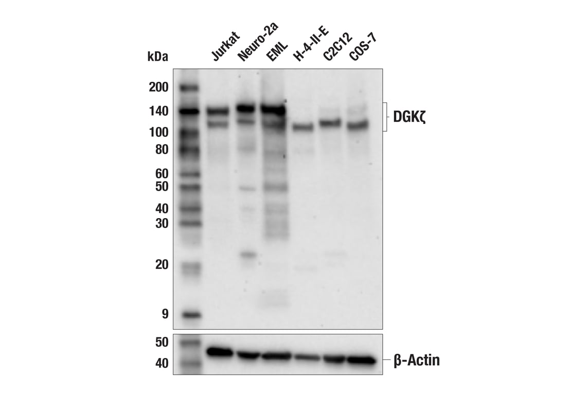 Western Blotting Image 4: DGK zeta (F6W7N) Rabbit Monoclonal Antibody