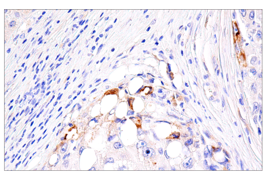 Immunohistochemistry Image 3: PAI-1 (E3I5H) Rabbit Monoclonal Antibody (BSA and Azide Free)