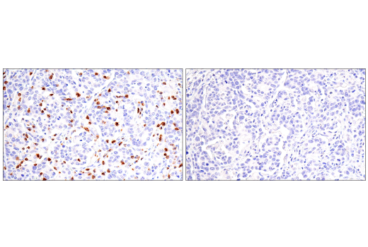Immunohistochemistry Image 5: CD7 (LP15) Mouse Monoclonal Antibody