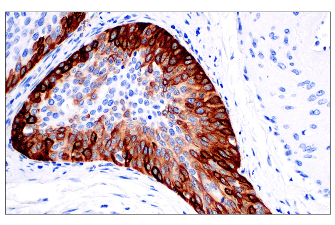 Immunohistochemistry Image 2: Keratin 14 (E7W6V) Rabbit Monoclonal Antibody (BSA and Azide Free)