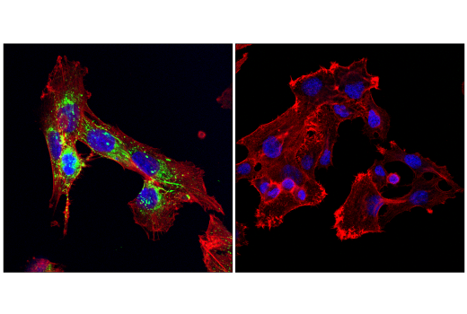 Immunofluorescence Image 1: Fibronectin/FN1 (E5H6X) Rabbit Monoclonal Antibody (BSA and Azide Free)