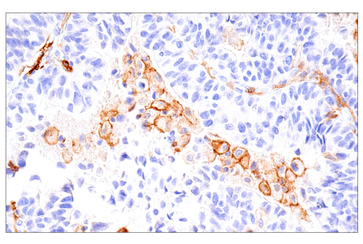 Immunohistochemistry Image 1: GM-CSF Receptor alpha (E8Z3S) Rabbit Monoclonal Antibody (BSA and Azide Free)