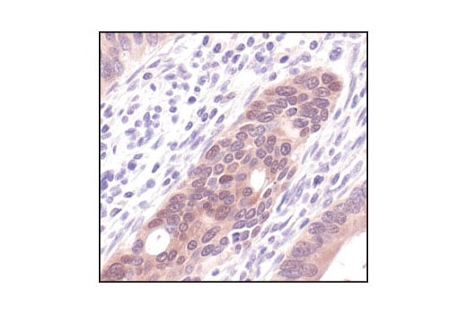 undefined Image 7: mTOR Substrates Antibody Sampler Kit
