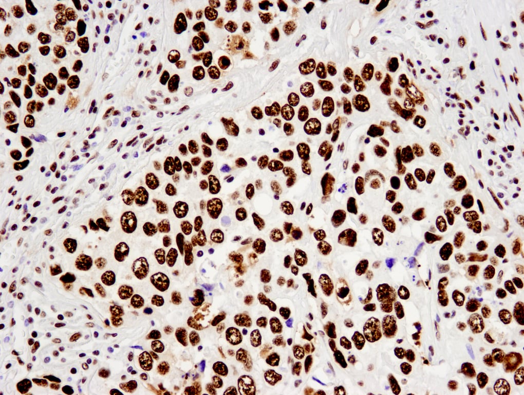 Immunohistochemistry Image 1: Nucleolin (D4C7O) Rabbit Monoclonal Antibody