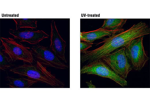Immunofluorescence Image 1: Phospho-MKK3 (Ser189)/MKK6 (Ser207) (D8E9) Rabbit Monoclonal Antibody