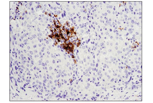 Immunohistochemistry Image 1: CD79B (D7V2F) Rabbit Monoclonal Antibody