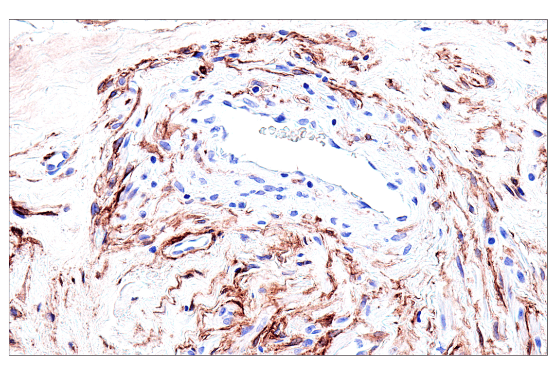 Immunohistochemistry Image 13: FAP (F1A4G) Rabbit Monoclonal Antibody (BSA and Azide Free)