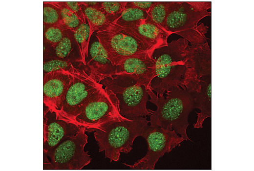 Immunofluorescence Image 1: ESET (D4M8R) XP<sup>®</sup> Rabbit mAb