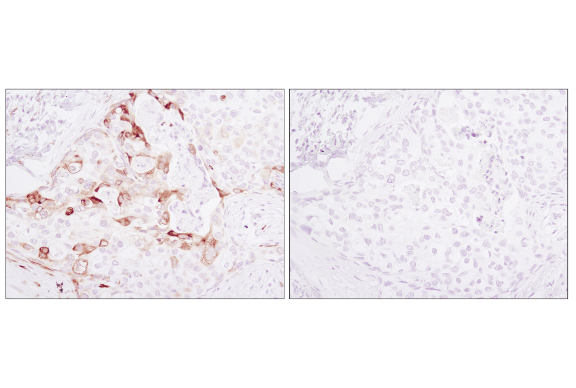 Immunohistochemistry Image 4: Phospho-S6 Ribosomal Protein (Ser235/236) (D57.2.2E) Rabbit Monoclonal Antibody (BSA and Azide Free)