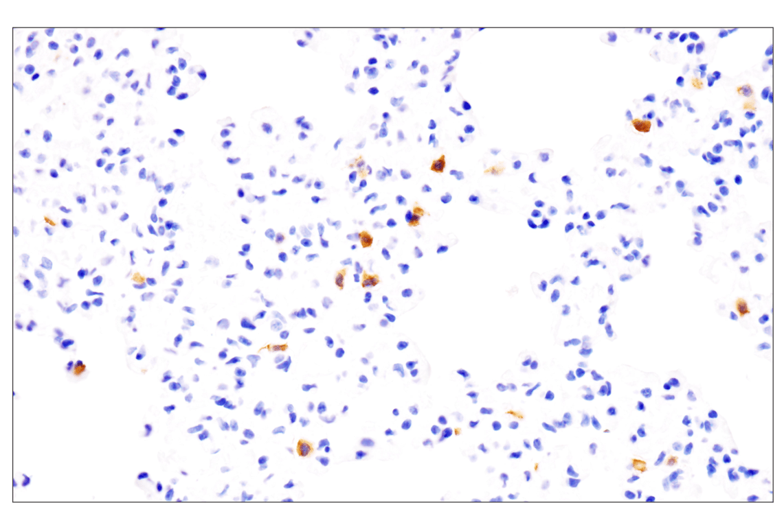Immunohistochemistry Image 5: IL-18 (E8P5O) Rabbit Monoclonal Antibody