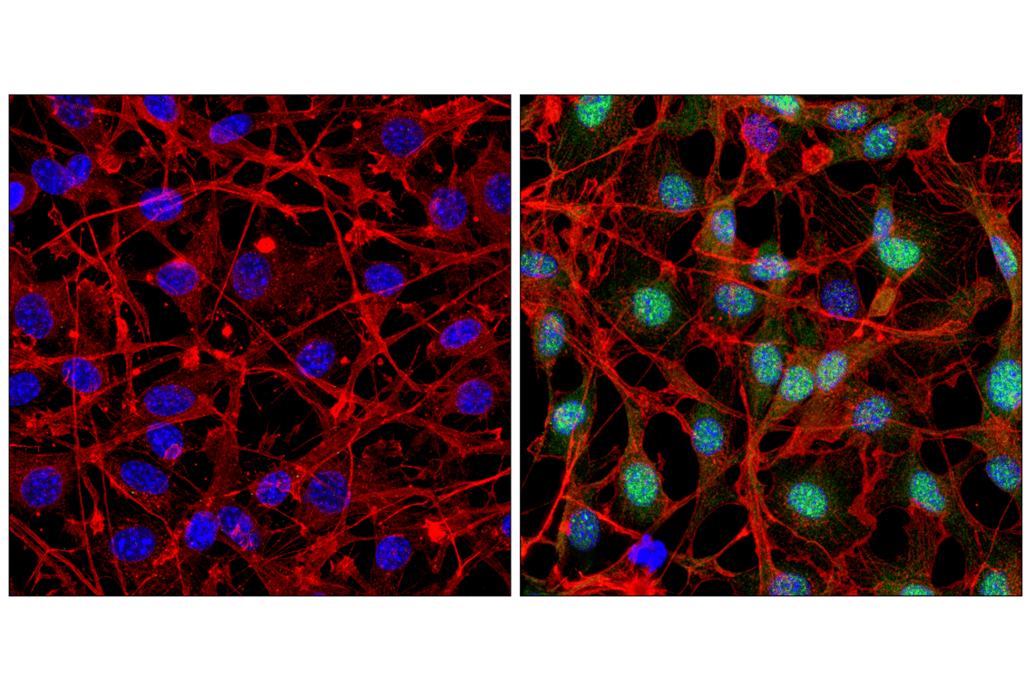 Immunofluorescence Image 1: Phospho-p44/42 MAPK (Erk1/2) (Thr202/Tyr204) Antibody