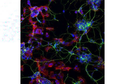 Immunofluorescence Image 1: beta3-Tubulin (D71G9) Rabbit Monoclonal Antibody (BSA and Azide Free)