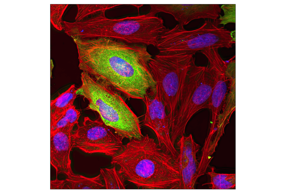 undefined Image 23: Epitope Tag Antibody Sampler Kit