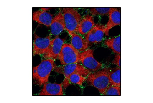 Immunofluorescence Image 1: alpha-N-Catenin (C12G4) Rabbit Monoclonal Antibody