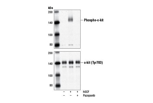 undefined Image 1: Pazopanib