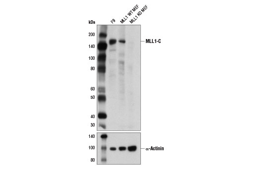 undefined Image 3: SET1/COMPASS Antibody Sampler Kit