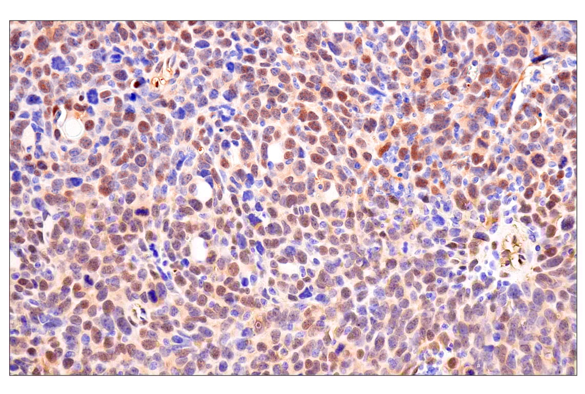 Immunohistochemistry Image 10: Phospho-YAP (Ser61) (E4Q8S) Rabbit Monoclonal Antibody