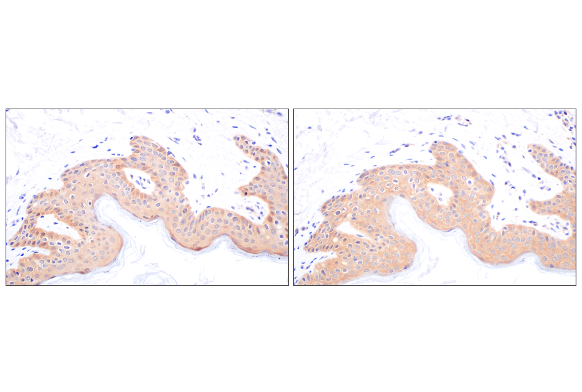 Immunohistochemistry Image 10: Galectin-8/LGALS8 (F9O3T) Rabbit Monoclonal Antibody