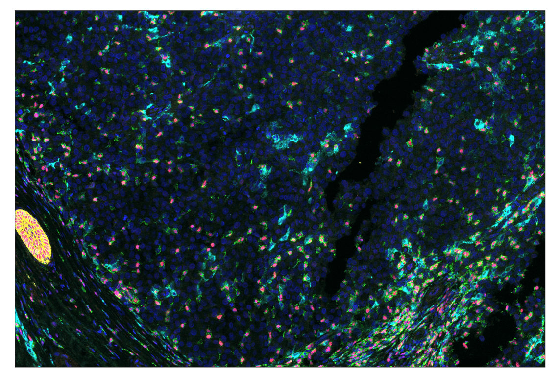 Immunohistochemistry Image 7: Anti-rabbit IgG & CO-0055-647 SignalStar<sup>®</sup> Secondary Antibody Kit
