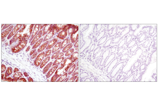 Immunohistochemistry Image 3: Non-phospho (Active) beta-Catenin (Ser33/37/Thr41) (D13A1) Rabbit Monoclonal Antibody (BSA and Azide Free)