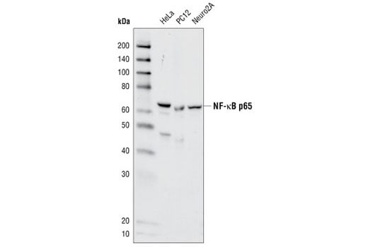 Western Blotting Image 3: NF-kappaB p65 (C22B4) Rabbit Monoclonal Antibody