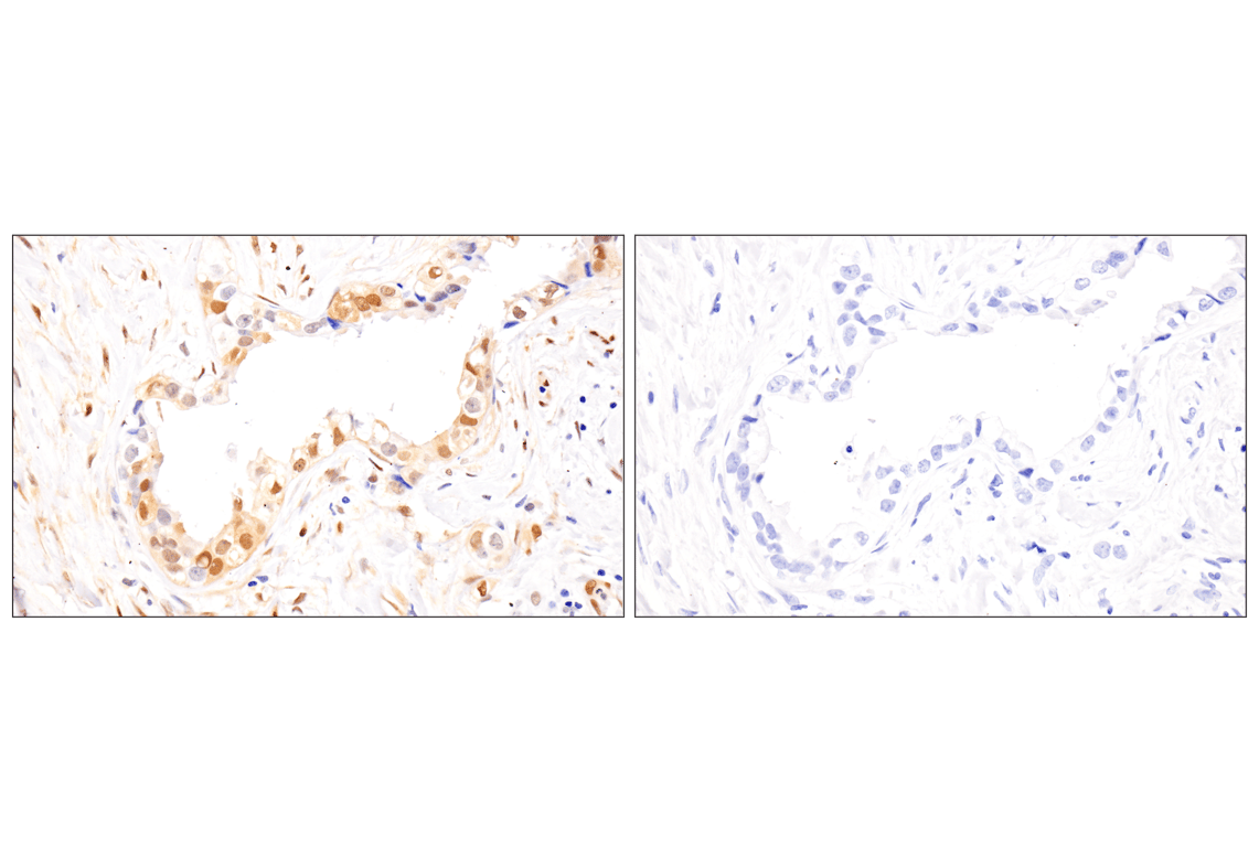Immunohistochemistry Image 12: Phospho-Stat3 (Ser727) (D4X3C) Rabbit Monoclonal Antibody (BSA and Azide Free)