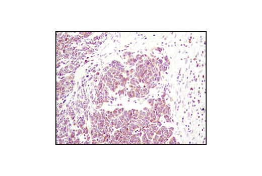 Immunohistochemistry Image 1: Bim (C34C5) Rabbit Monoclonal Antibody (BSA and Azide Free)