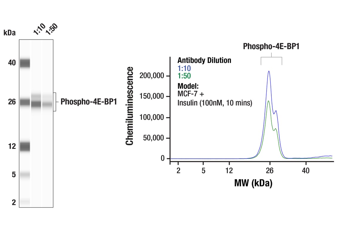 Western Blotting Image 1: Phospho-4E-BP1 (Ser65) (D9G1Q) Rabbit Monoclonal Antibody