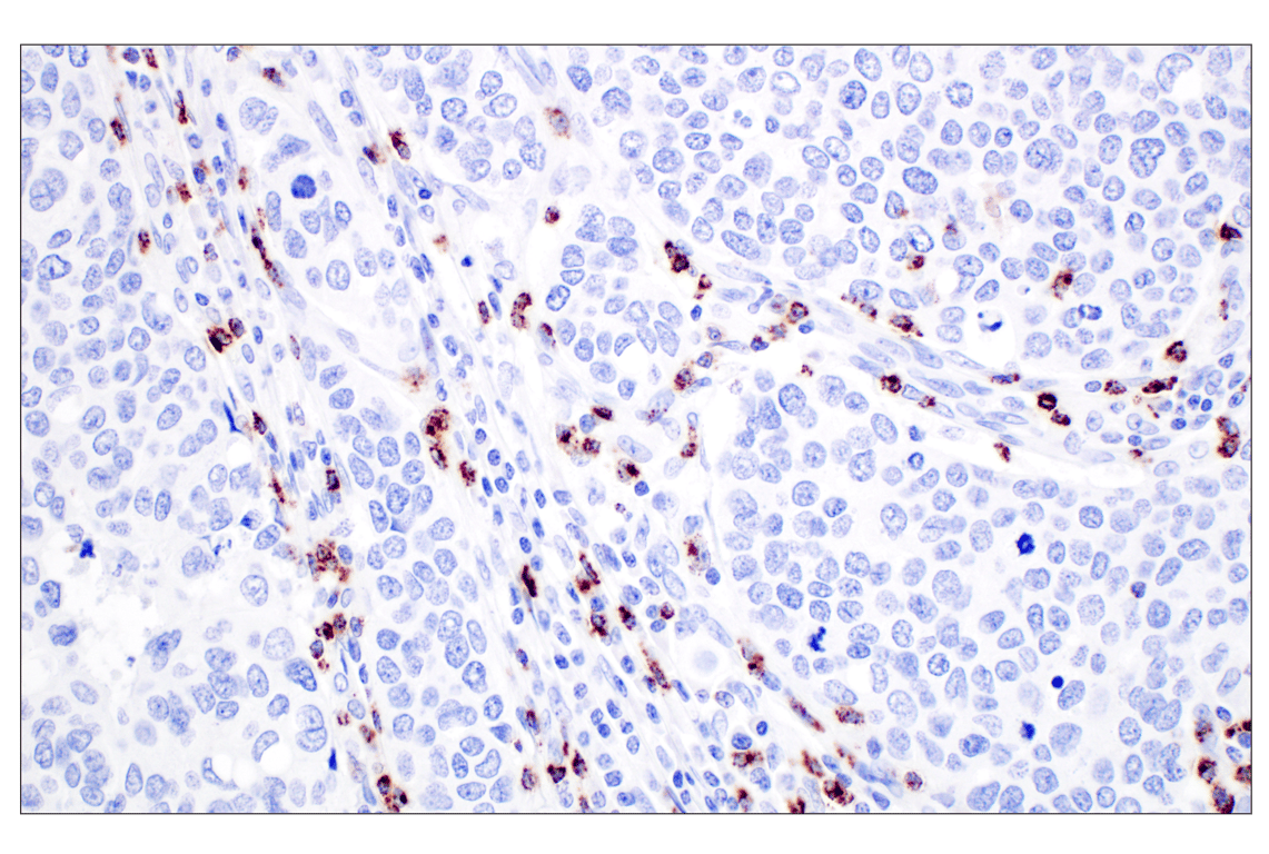 Immunohistochemistry Image 2: NKG7 (F4V5I) Rabbit Monoclonal Antibody