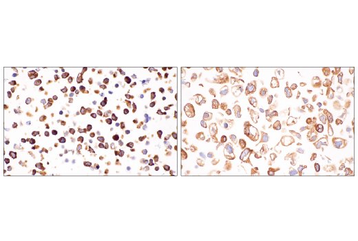 Immunohistochemistry Image 18: UBAP2L (E5X4E) Rabbit Monoclonal Antibody