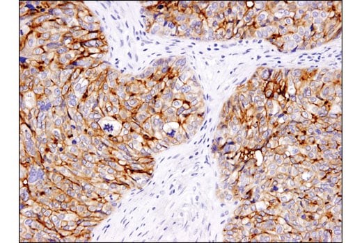 Immunohistochemistry Image 1: B7-H4 (D1M8I) Rabbit Monoclonal Antibody