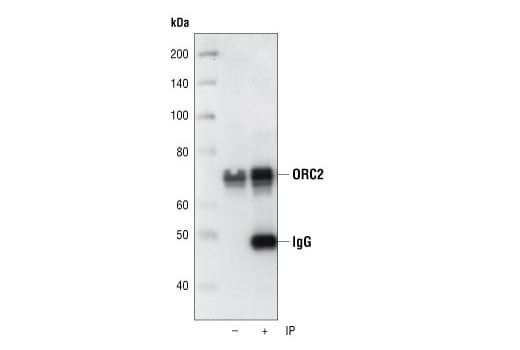 Immunoprecipitation Image 1: ORC2 (3G6) Rat Monoclonal Antibody
