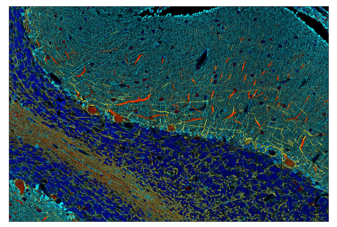 Immunohistochemistry Image 1: S100B (E7C3A) & CO-0126-594 SignalStar<sup>™</sup> Oligo-Antibody Pair