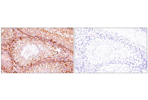 Immunohistochemistry Image 9: LAMP1 (E6N3R) Rabbit Monoclonal Antibody