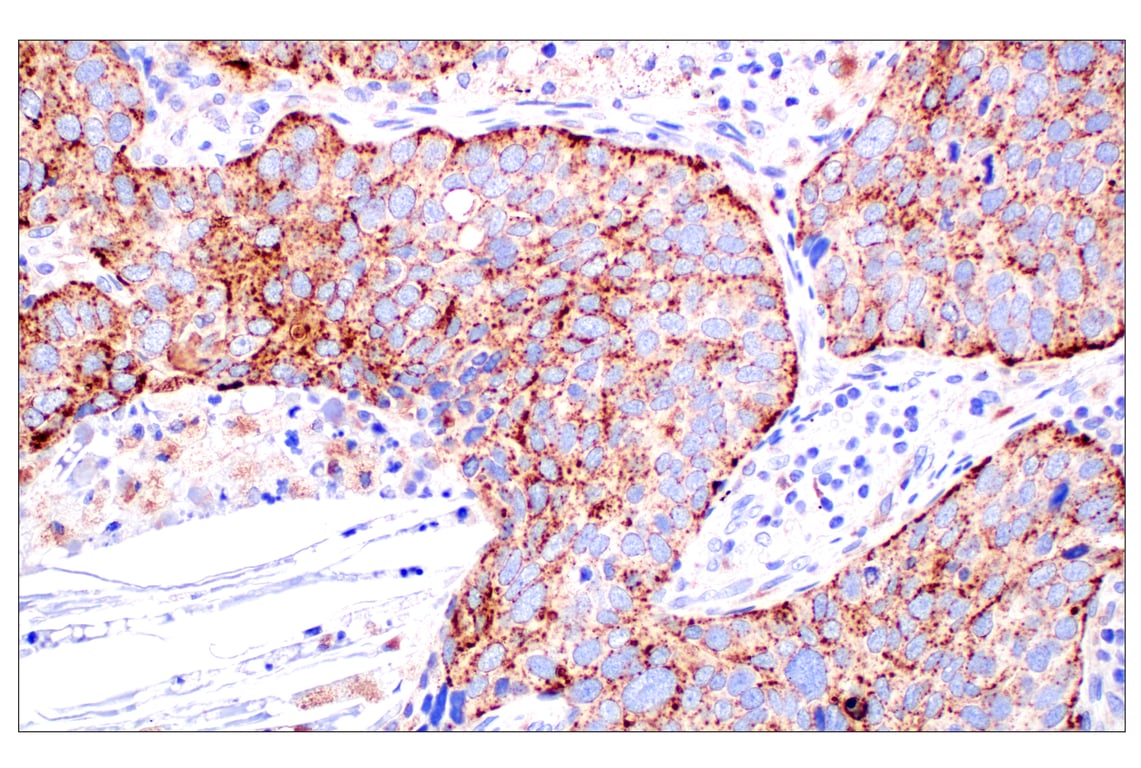 Immunohistochemistry Image 1: NPC1 (E7S4N) Rabbit Monoclonal Antibody