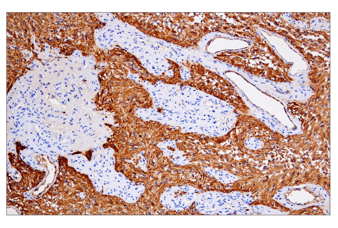 Immunohistochemistry Image 1: GFAP (E4L7M) Rabbit Monoclonal Antibody