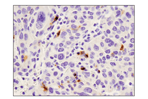 Immunohistochemistry Image 4: PD-L1 (D5V3B) Rabbit Monoclonal Antibody