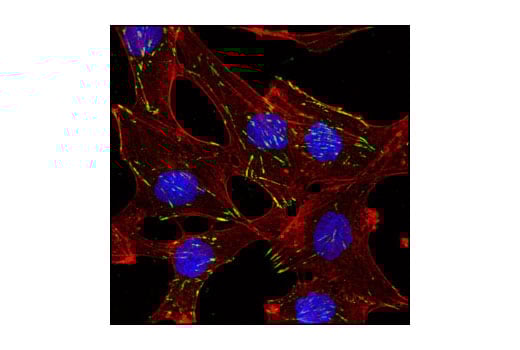 Immunofluorescence Image 1: Integrin beta5 Antibody