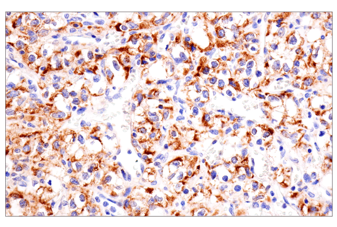 Immunohistochemistry Image 5: AMACR (F7T6V) Rabbit mAb